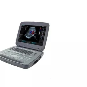 Ультразвуковой сканер Siemens P500